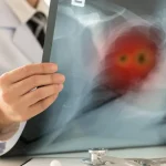 Ce se întâmplă cu plămânii după ce renunți la fumat. De ce foștii fumători rămân mai vulnerabili la anumite boli