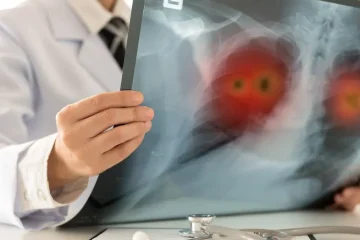 Ce se întâmplă cu plămânii după ce renunți la fumat. De ce foștii fumători rămân mai vulnerabili la anumite boli